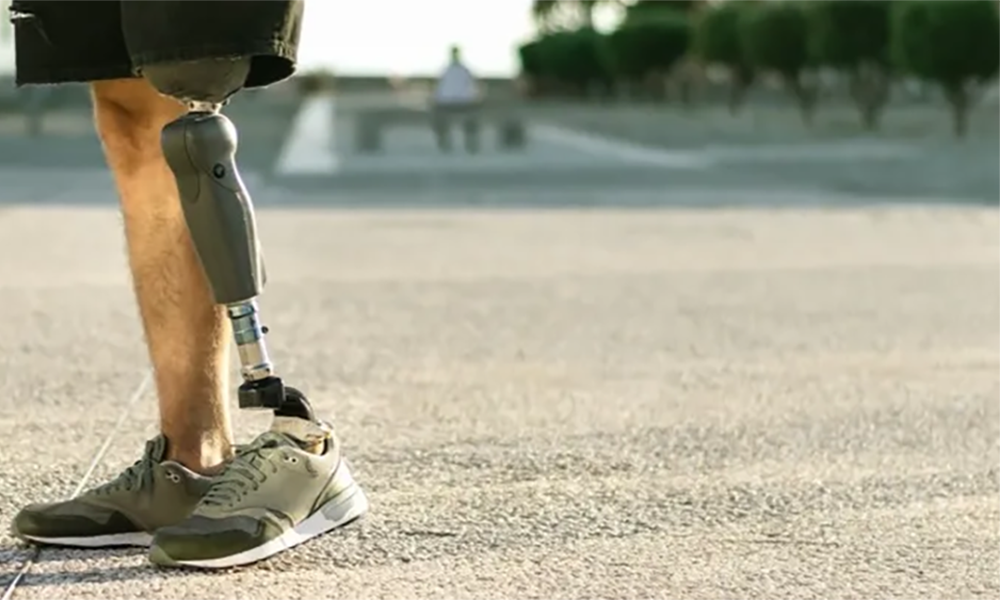 Microminiature Solutions for Prosthetic Applications Microminiature Solutions for Prosthetic Applications